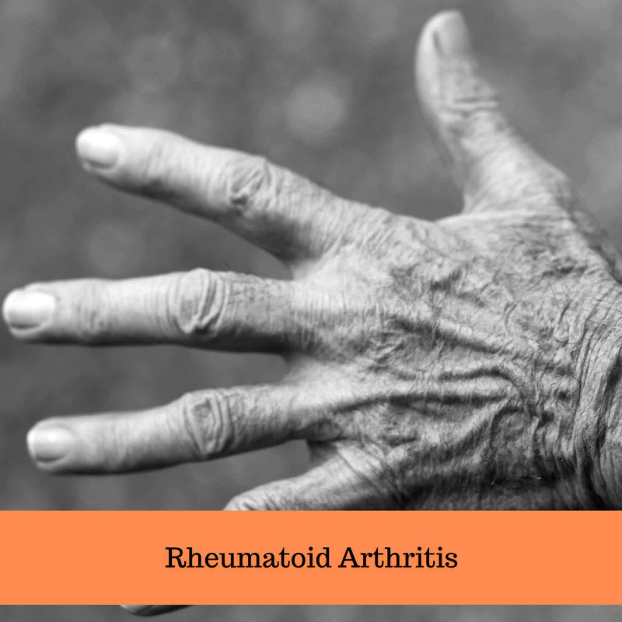 Naturally Relieving Rheumatoid Arthritis Symptoms